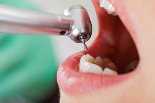 Best Knocked-Out Tooth Emergency  in Scottsville, NY
